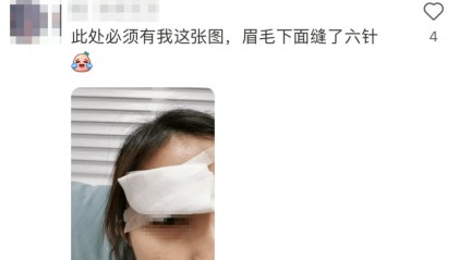 击穿眉骨、扎穿手指…这项人气运动暗藏风险！