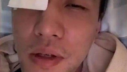 郭艾伦病床上接受采访 ：医生说不会影响以后视力