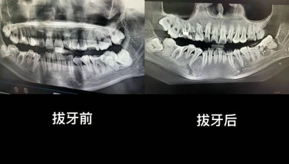 “痛到崩溃”！市卫健委回应“女子在医院跳楼”