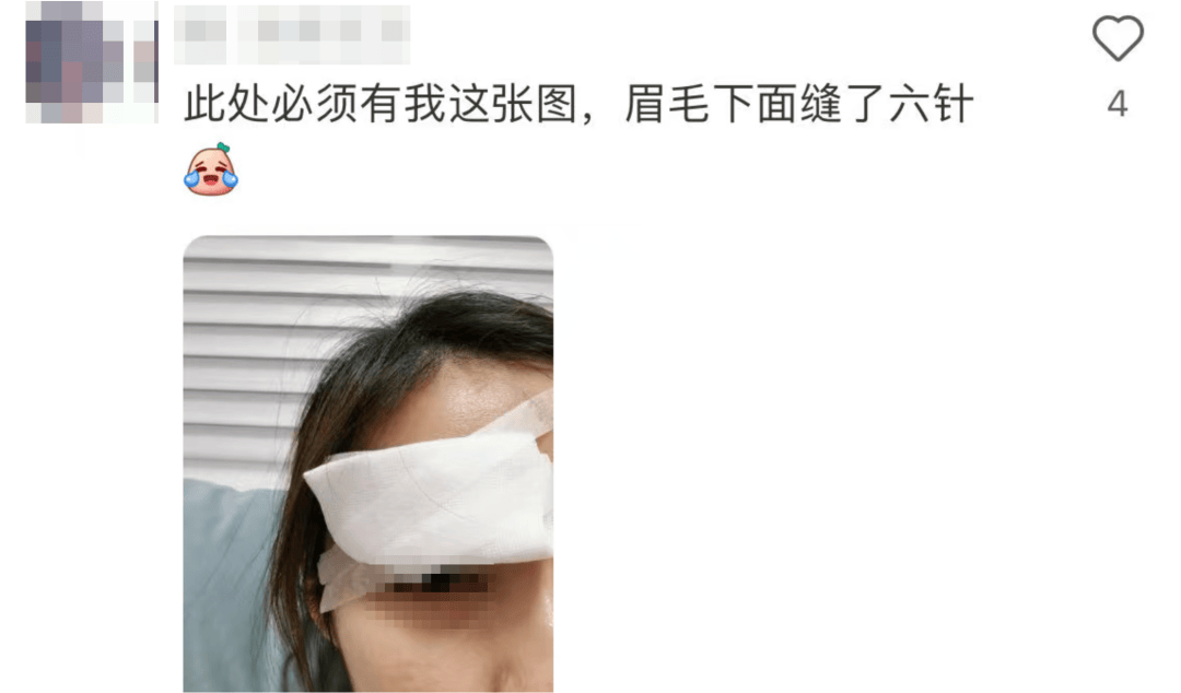 击穿眉骨、扎穿手指…这项人气运动暗藏风险！