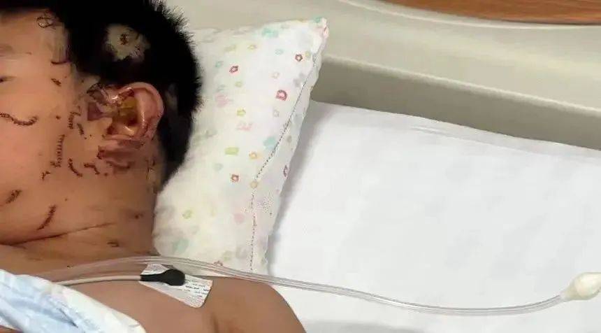 突然爆炸！这个常见保鲜品暗藏危险！