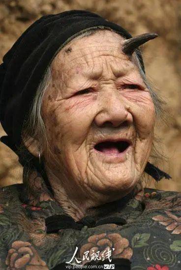 太狠了！98岁阿婆拿起剪刀，对准自已一刀下去…后果很严重！